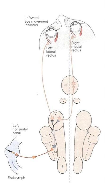 Spontannystagmus er enten CNS eller «Øret» CNS = Cerebellum eller hjernestammen «Øret» = Ensidig vestibulær