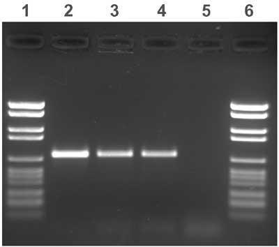11. Resultatvurdering Brønn nr 1 og 6, er ladder som består av flere standardstørrelser av DNA.