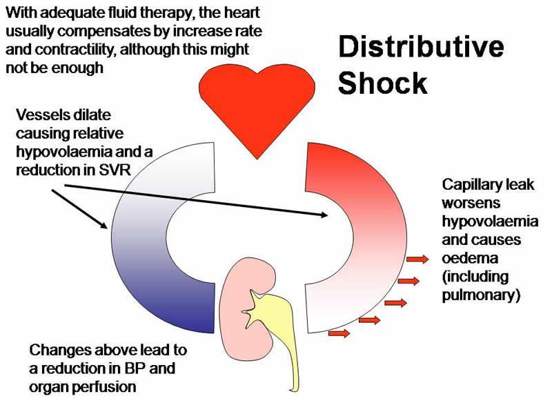 Scottish Intensive Care