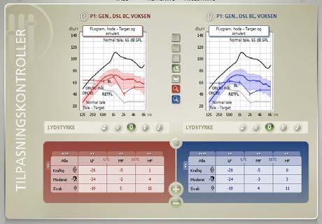 Perfekt passform på et øyeblikk Den nye intuitive Genie Medical gjør det enklere for audiografer å gi en mer individualisert