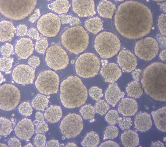 3 Stamceller Det er ingen tvil om at humane stamceller og laboratorieprodusert vev og organer basert på humane stamceller kommer l å være vik ge elementer i frem dens medisin.