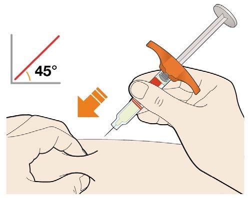 3. Sett kanylen i hudfolden med ca. 45º vinkel. 4. Press stempelet ned.