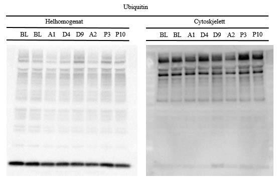 Figur 3.5. Representative Western Blot for ubiquitin i helhomogenat og cytoskjelett.