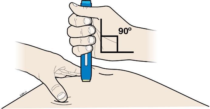 Trinn 3: Injiser G. Fortsett å holde fast eller strekke huden.