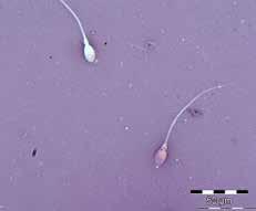 Spermiekonsentrasjon, sædvolum og totalt antall spermier For bestemmelse av spermiekonsentrasjon og totalt antall spermier telles kun spermier med både hode og hale.