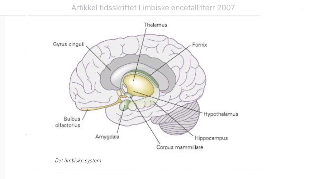 Limbisk encefalitt en diagnostisk utfordring Anette