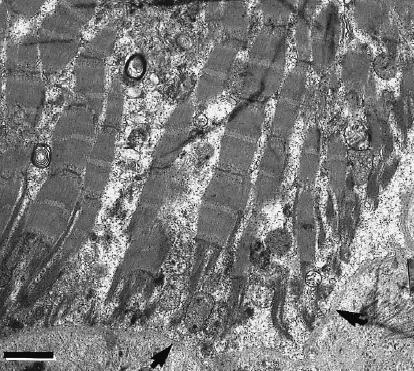 Gaping Fig.I: før gaping Fig.II: gaping (Fig.5 og 8, Fletcher et al.