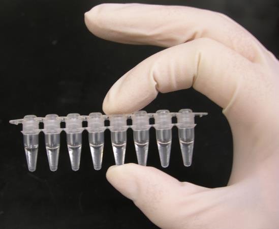 PCR Svært følsom metode Mest brukt til screening og bekrefte tilstedeværelsen av amøber.