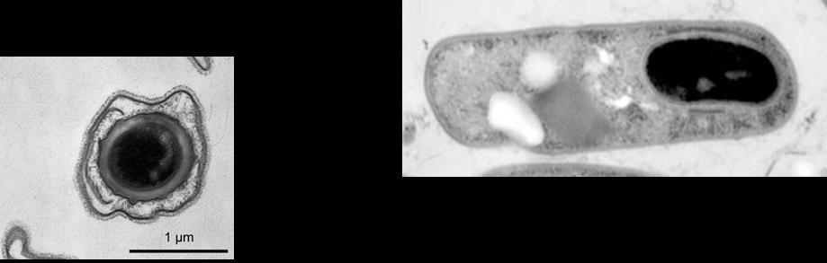 Melk som substrat for mikroorganismer Psychrotrofe bakterier i melk : - I råmelk er 1-10 % av totalantallet psychrotrofe