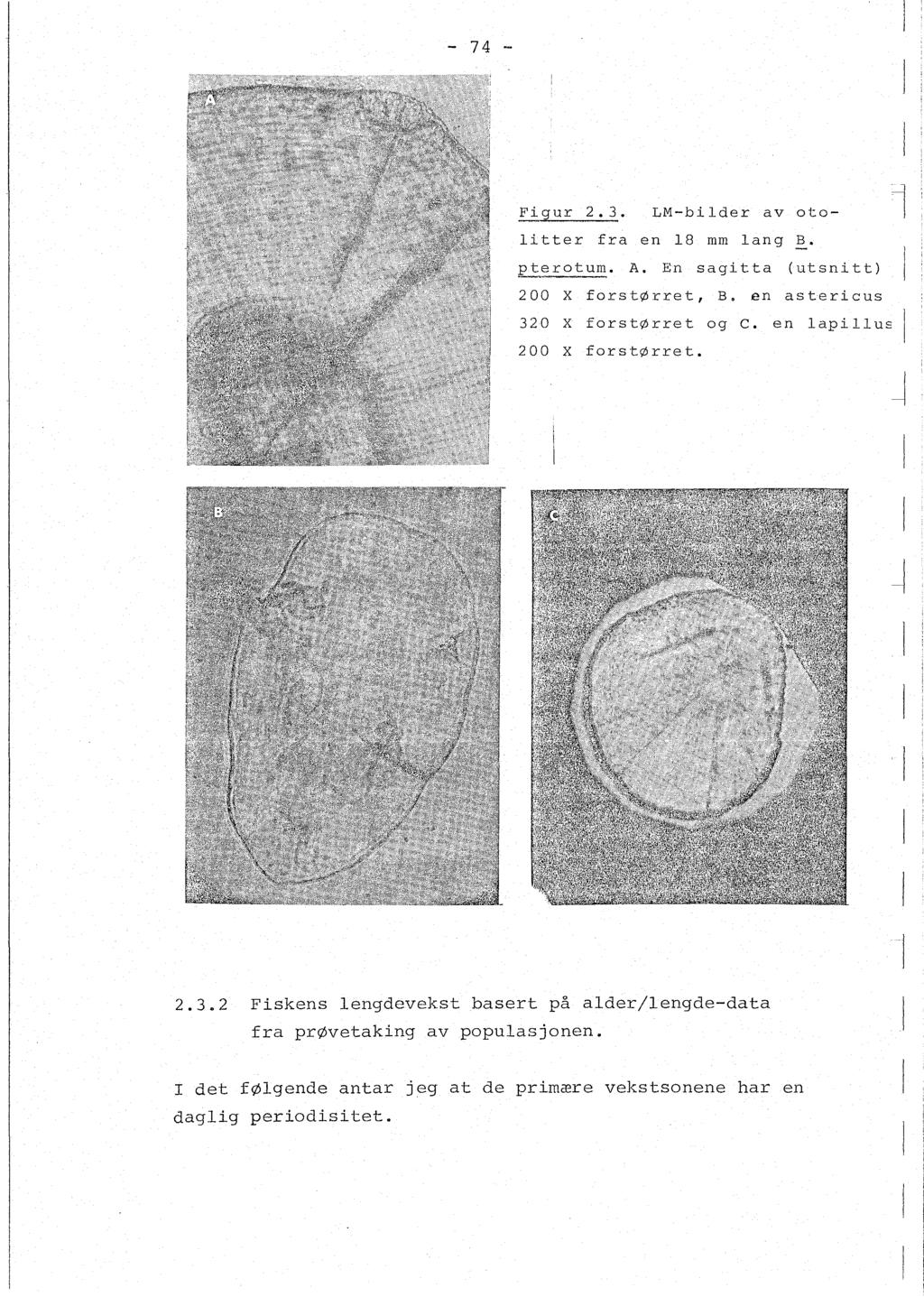 - 74 - Figur 2.3. LM-bider av otoitter fra en 18 mm ang B. pterotum. A. En sagitta (utsnitt) 200 X forstørret, B. en astericus 320 X forstørret og c.