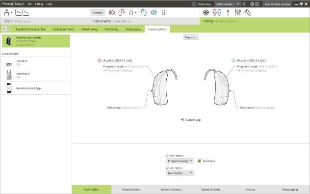 Resultater fra fonemoppfatningstest Resultater fra en foregående fonemoppfatningstest kan vises og brukes til å forbedre tilpasningen.