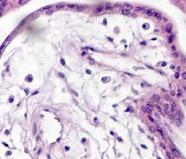 5 2.1.1 6. gestasjonsuke Chorionplaten består av embryonalt mesenchym med løsmasket bindevev, som inneholder allantoiskar. Stamtottene forgrener seg ut fra chorionplaten og tar opp allantoiskarene.
