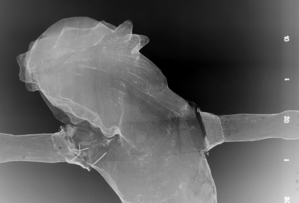 plugg? Original innfelling av armene fra baksiden Rester av sekundært kitt Figur 22 Røntgenbilde av krusifiksets overkropp, hode og armer. Pluggene i innfellingen er vanskelige å se på røntgenbildet.