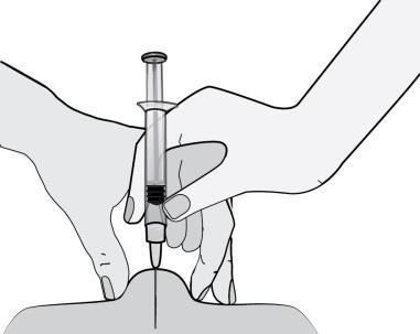 injisere. En lenestol, liggestol eller en seng med mange puter er ideelt. 3) Velg et område på venstre eller høyre side av magen. Dette skal være minst 5 cm unna navlen og sidelengs utover.