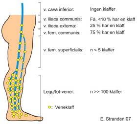 Bare i leggene er det over hundre klaffer. De er plassert tettest sammen distalt 1 i området rundt anklene, der trykket er lavest, og gradvis lengre fra hverandre høyere opp i benet (figur 3).