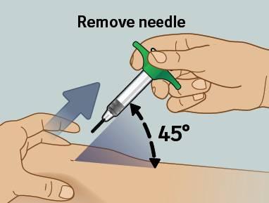 10) Fjern nålen fra huden Fjern nålen Fjern nålen fra huden i same vinkel som du satte den inn