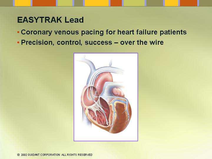 Dyssynkroni Ved hjertesvikt og intraventrikulær