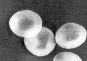 Slika 42. Nepromenjeni eritrocit elektronski mikroskop (orig.