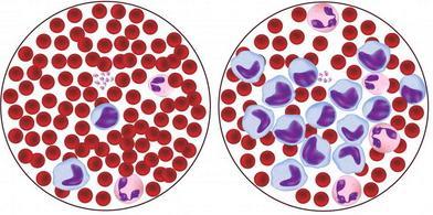 makrofag, koji prima specifiĉne karakteristike tkiva i organau kome se nalazi: Kupferove ćelije jetre, alveolarni makrofag,