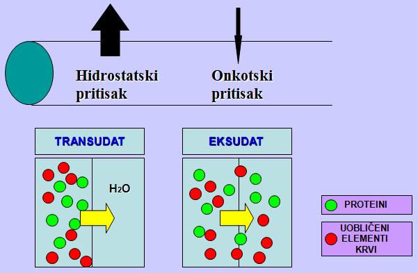 Transudat i eksudat - Lokalni edem u peritonealnoj šupljini nazive se hydrops ascites, hydrotorax je edem u pleuralnoj šupljini, a hydropericardium je edem u perikardijumu.