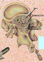 effect site for legemidlene Spinalrommet er fylt av væske, kortere avstand til effect site og sannsynlig jevnere distribusjon av legemidler Doseforholdet spinalt til epiduralt ca 1 : 10 Spinal