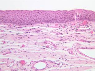 Anatomi og histologi A. Hypofarynks B. Larynks 2.