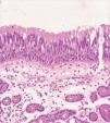 subglottisk: pseudoflerlaget, ciliert, respiratorisk epitel OBS: overgangsepitel B. Larynks: histologi - submucosa B.