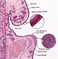 Laryngocele-generell laryngeal ventrikkel/sinus har en liten utposning; sacculus/laryngeal appendiks Laryngocele - abnormal dilatasjon av