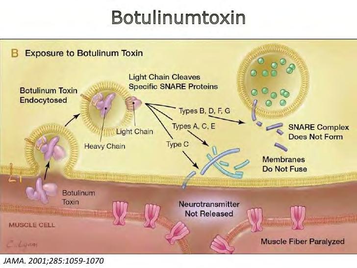 Botulinum toksin Nervegift, Cl botulinum Forhindre frigivelse av AcH nevromuskulære synapse Muskel relaksasjon/ paralyse