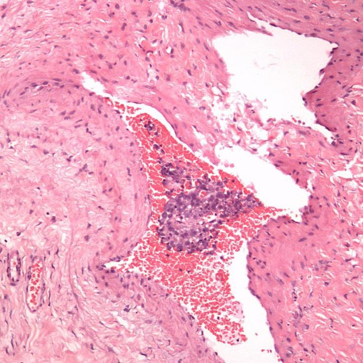 Forurensing - ofte dårlig fiksert vev (eksempel fra testis, men gjelder alt med