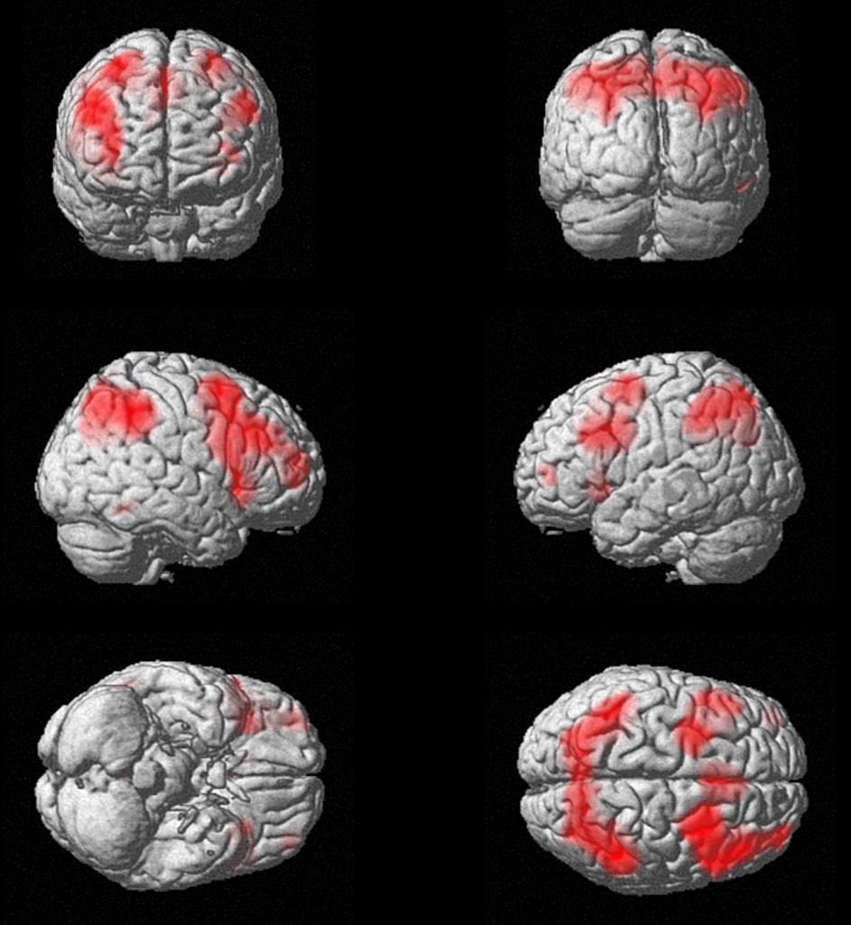 MTL BOLD fmri i POP: N-back