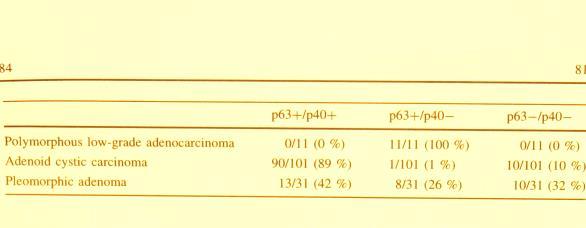 salivary gland carcinoma composed of malignant cells with clear cytoplasm, with or without