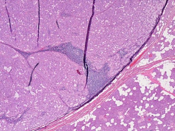 Kasus 9: Pike 13 år. Tumor foran hø øre.