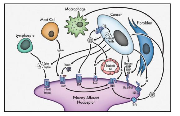 Neurobiologi ved cancersmerte Hva om mekanismene bak cancersmerte er andre enn ved