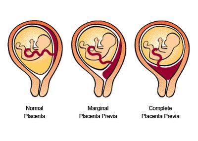 PLACENTA