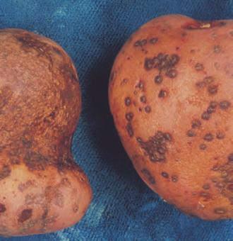 Viktigste smittekilde er infiserte Skin spot Sopp Potato gangrene Sopp sprang i åkeren. Utsatt høstetid og setting i kald jord gir økt angrep. Mye jord inn på lager øker angrepet.