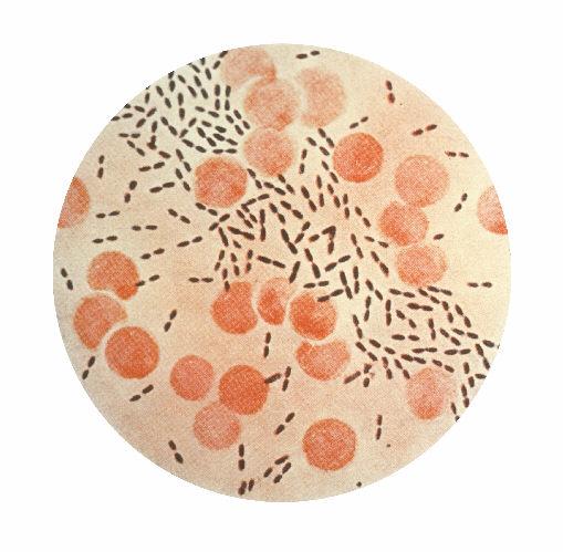Hvordan vil du bekrefte artsidentifikasjonen ved oppvekst av bakterien? et vil være beta-hemolyse rundt koloniene, og positive optochin og indol tester.