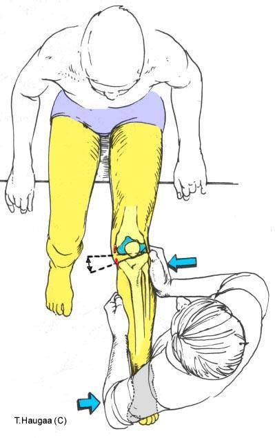 5.21 Test av de collaterale ligamentene Fig 091.