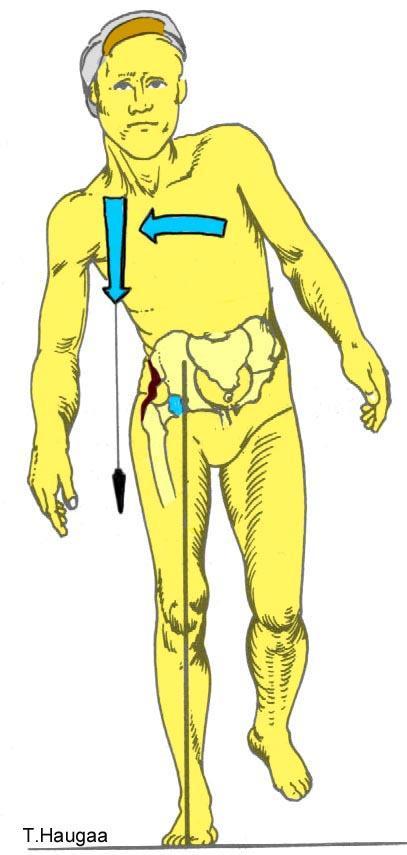 8.7 Gluteus medius (L5) helling Fig 139.