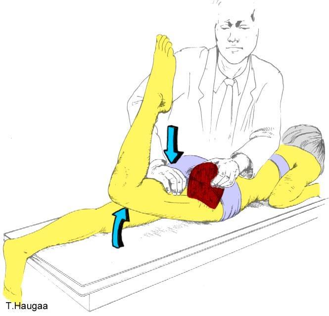 8.23 Test av m. gluteus maximus Fig 155. Test av musculus gluteus maximus.