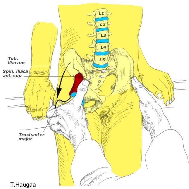 8.32 Palpasjon av Trochanter major Fig 164.