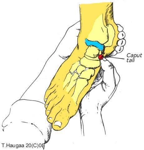 4.6 Caput tali. T. Haugaa Fig 038. Før tommelen ca 2 fingerbredde frem fra malleolen, så finner du caput tali.