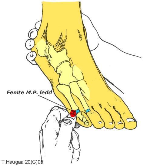 4.11 Grunnleddet 5.te metatarsalknokkel T. Haugaa Fig 043. Grunnleddet 1.