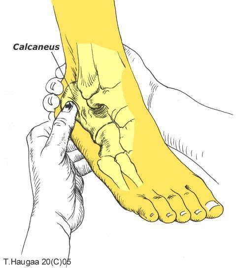 4.14 Os calcaneus T. Haugaa Fig 046. Calcaneus er lett å lokalisere.