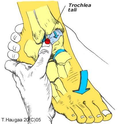 4.19 Trochlea tali T. Haugaa Fig 051.