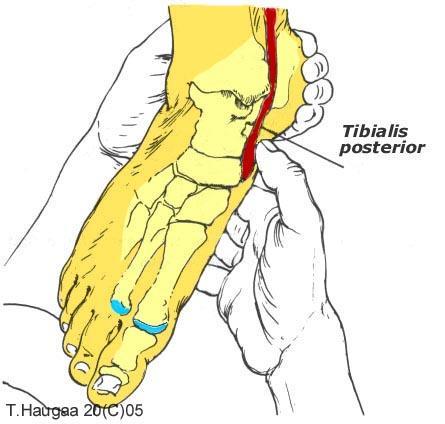 4.25 Musculus tibialis posterior T. Haugaa Fig 057.