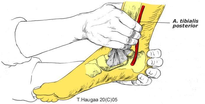 4.29 Arteria tibialis posterior Fig 061.