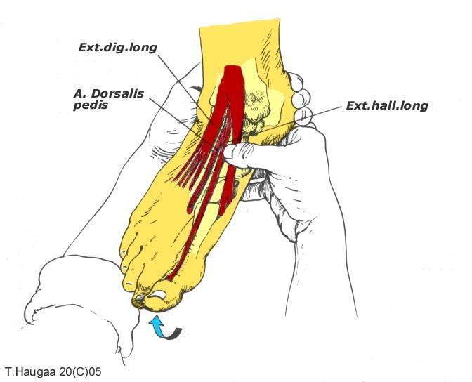 4.31 Musculus ext. hall. Long og ext. dig. long T. Haugaa Fig 063.