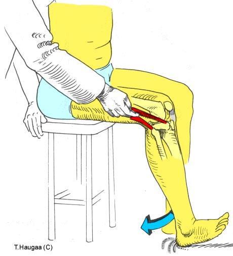 5.18 Palpasjon av Tractusiliotibialis Fig 088.