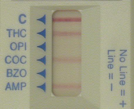 Hurtigtester Prinsipp Immunologisk metode Antigen/antistoff reaksjoner på spesialpreparerte teststrimler.